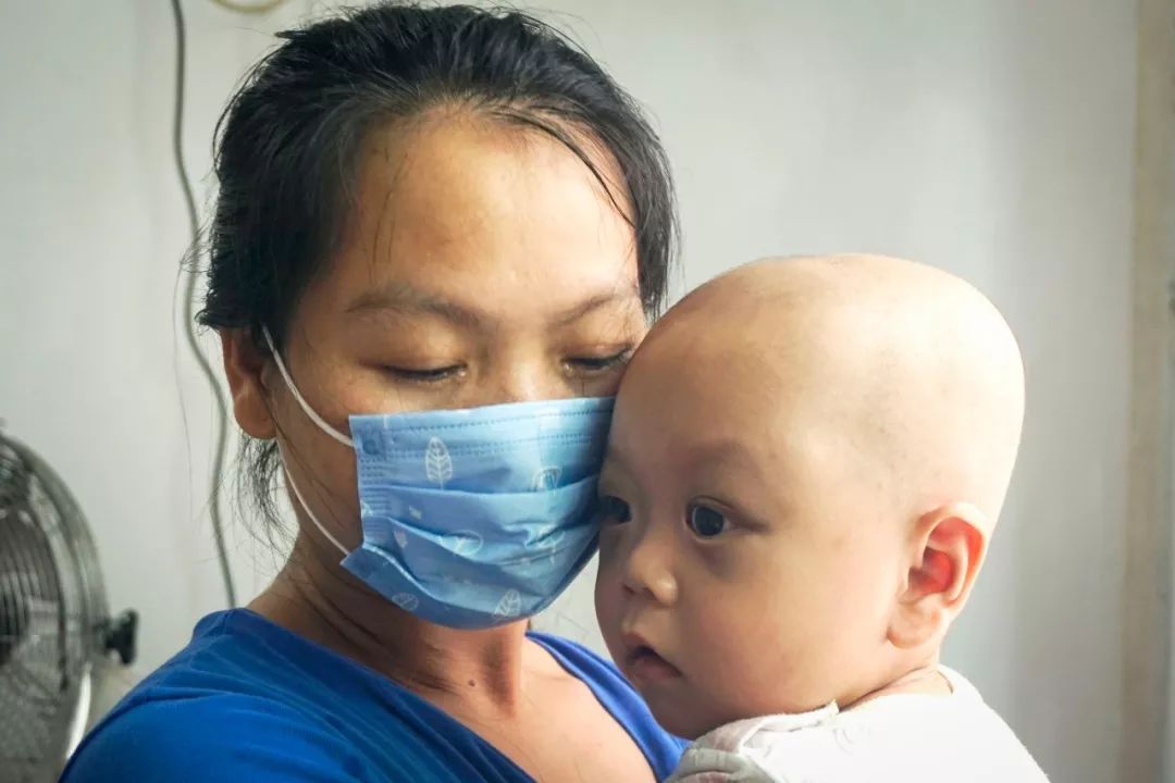 小男孩双眼淤青肿胀，酷似熊猫眼，父母曾被人怀疑虐待孩子