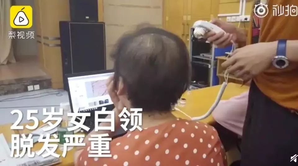 女生头发干枯脱发严重,脱发正在猛袭90后5招让头发变浓密