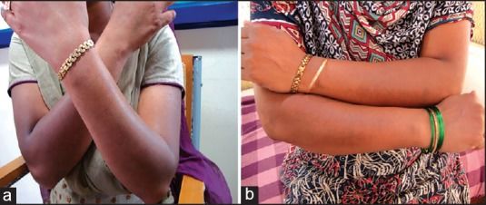 用力搓澡会让皮肤越搓越黑,身体黑搓澡可以搓白吗