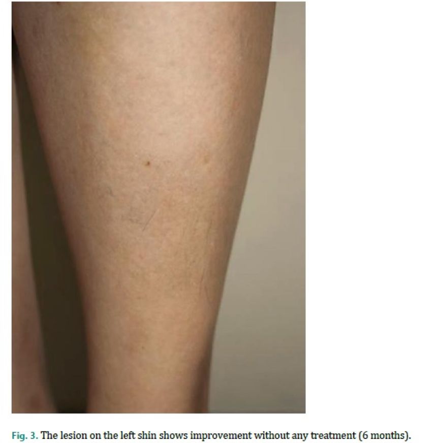 用力搓澡会让皮肤越搓越黑,身体黑搓澡可以搓白吗