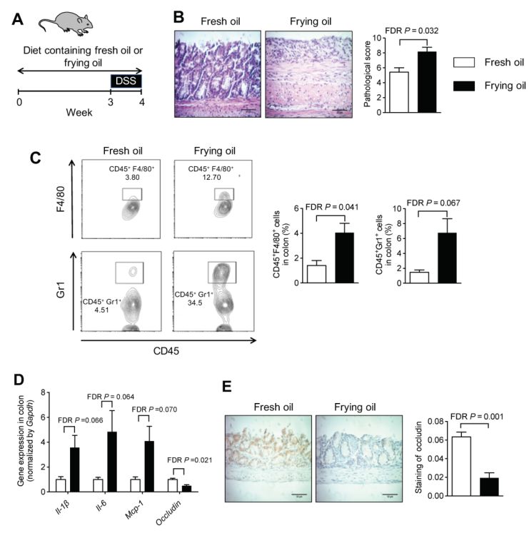 饮食油腻容易得胰腺肿瘤,饮食因素对肠癌的影响