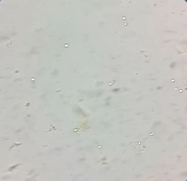 天呐，女儿大便里竟然有“霉菌”