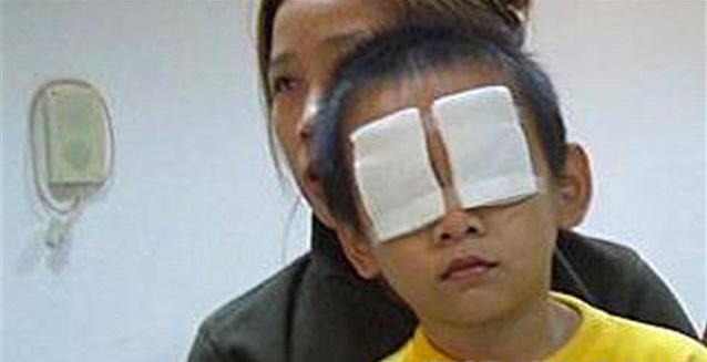 婴儿把石灰弄到眼睛里会怎么样,孩子把石灰撒进眼睛