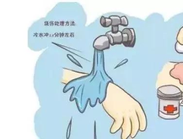 被乌龟咬了要不要打疫苗,乌龟咬了需要打狂犬疫苗吗