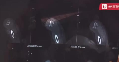 八旬老汉互殴,六旬翁和七旬老人打架怎么处理