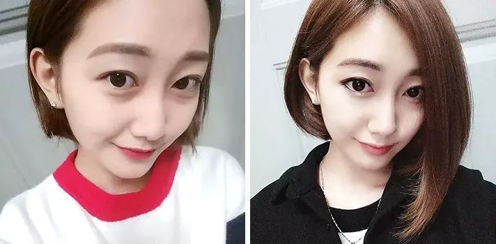 在美国治疗痔疮经历,在美国最好卖的痔疮药