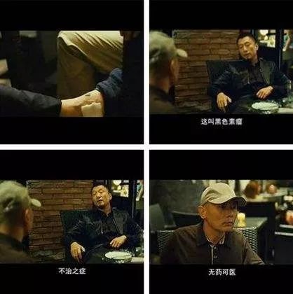 痣一边黑一边白是癌的征兆吗,痣变黑变大是癌变了还是癌前病变