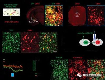 中国科大等在疼痛致抑郁症研究方面取得进展