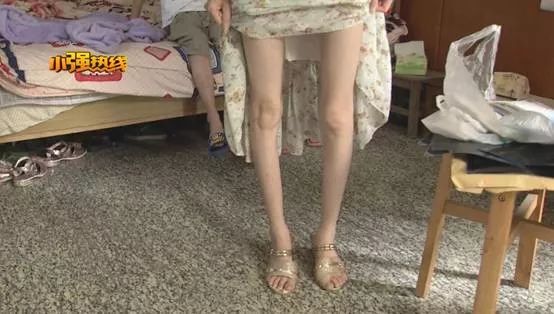 生下一对儿女后只剩54斤她怎么成了“纸片人”？