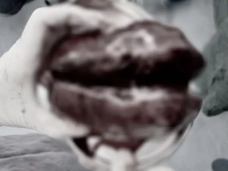 老年人肚子突然大得像怀孕,老人肚子变大圆鼓鼓的很硬不难受