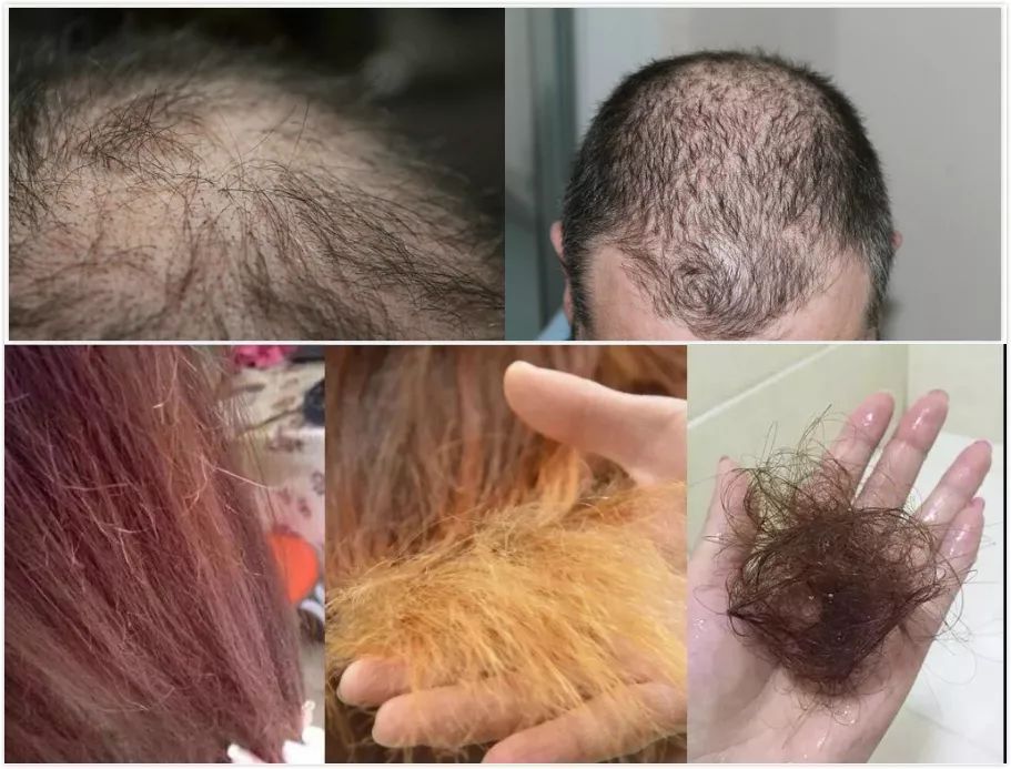 负离子吹风机200块,不超过100元的吹风机推荐