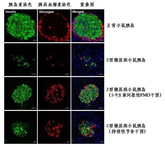 节食能治疗糖尿病么,通过节食治疗糖尿病