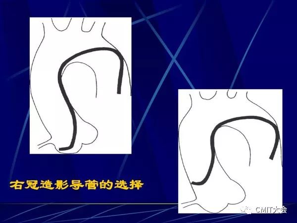 跟我学技术分析从入门到精通,跟我学技术
