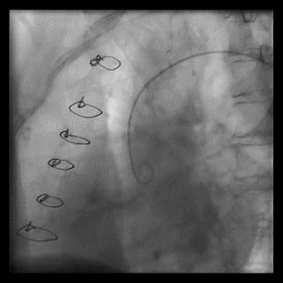 跟我学技术分析从入门到精通,跟我学技术