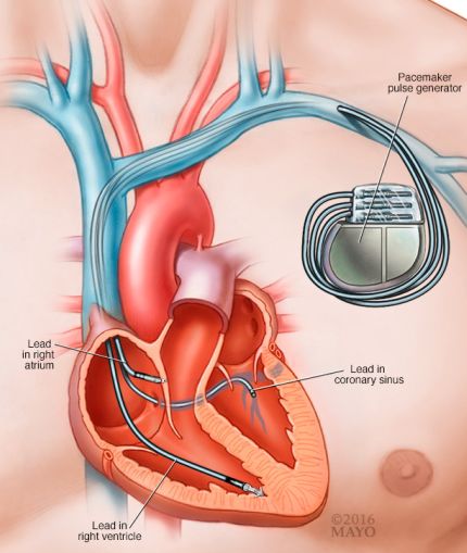 crt-p与crt-d的区别,crt-d是什么