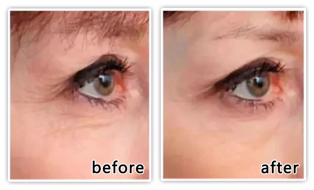 坚决不做“黄脸婆”！有了它，再差的皮肤都有救！丨开团