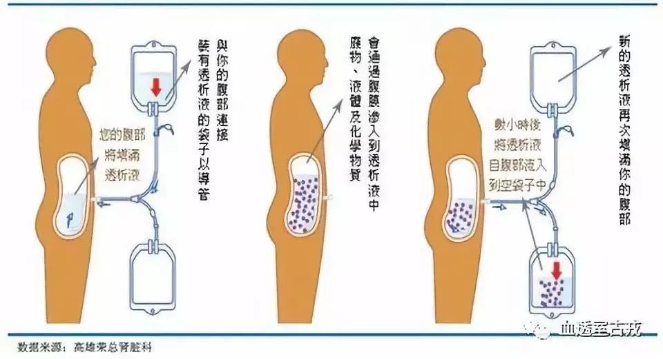 透析病人输头孢的副作用,透析用的生血针的副作用