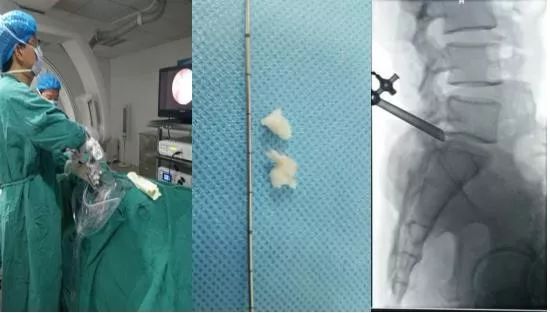 山东疼痛医学研究中心,中国最权威疼痛专科医院