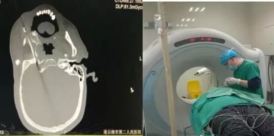 山东疼痛医学研究中心,中国最权威疼痛专科医院