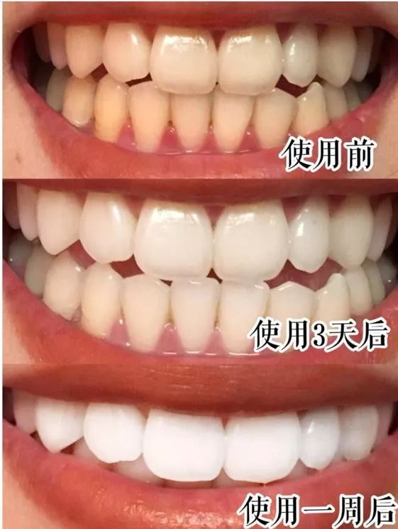 俄罗斯牙膏美白去口臭牙黄,去牙垢黄牙的牙膏测评