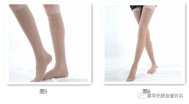 胃底静脉曲张,睾丸静脉曲张