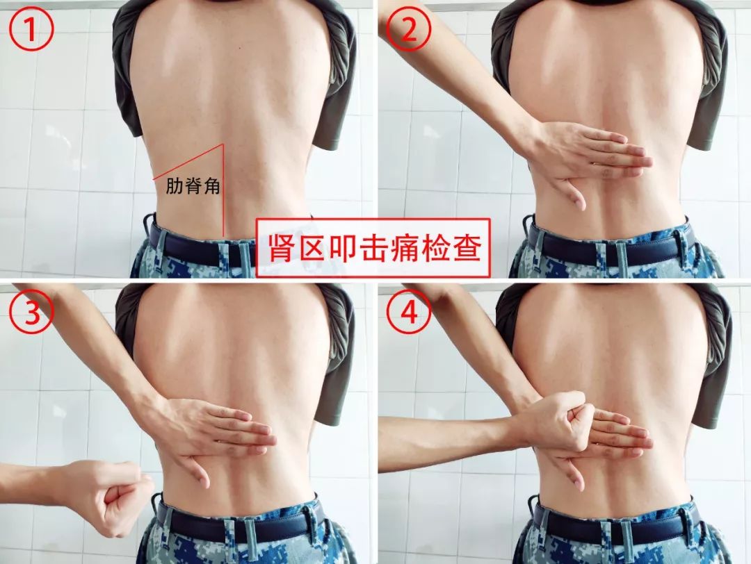 军医在线|多饮水、勤排尿，远离尿路感染没烦恼