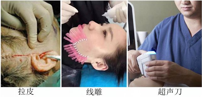 这款急救弹性蛋白贴，每天一片赶走干纹，还你天鹅美颈