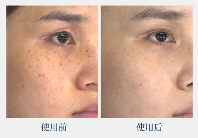 44岁的她竟睡服半个娱乐圈，被亿万直男跪舔！遭小S妒忌十年：凭什么？