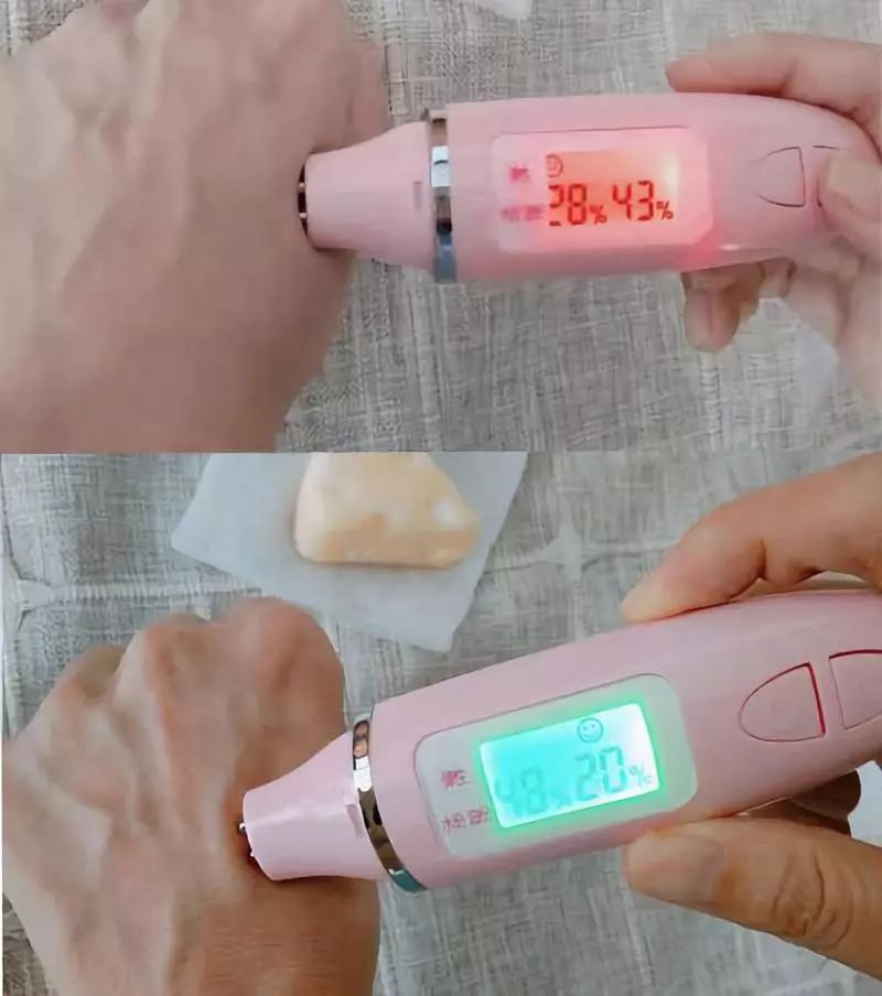 鼻头痘痘爆浆,鼻头痘痘挤出来的白色物质是什么