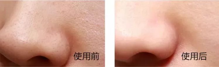 欧莱雅控油保湿女士洗面奶,欧莱雅控油炭爽洗面奶男女通用