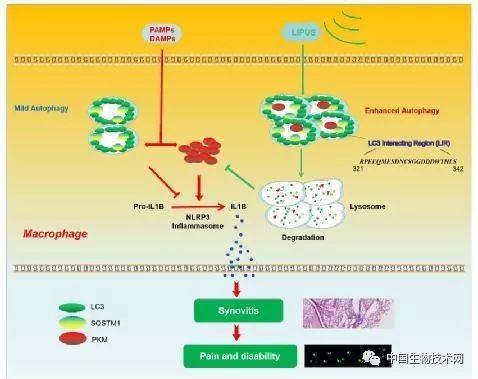 骨关节炎无创治疗新进展：低强度脉冲超声缓解骨关节滑膜炎和自噬相关