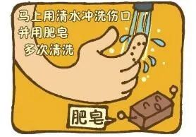 被狗咬了三天了怎么办,被狗咬了怎么办不伤手