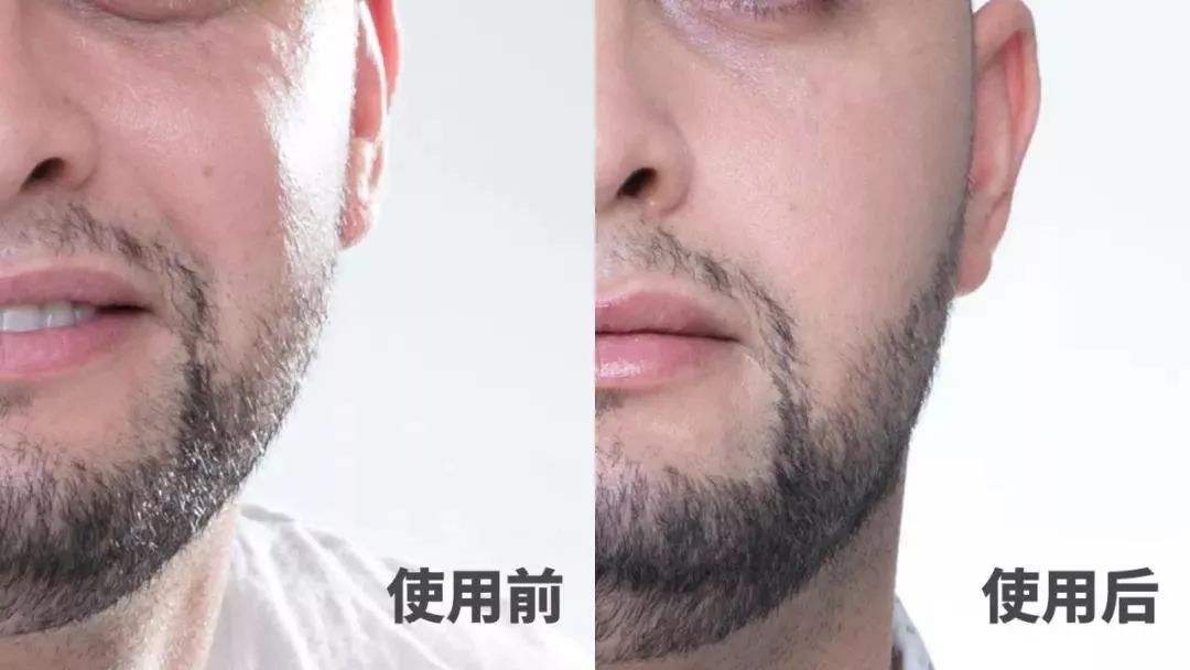 日本黑科技磁石瘦脸耳环,日本磁吸瘦脸耳环