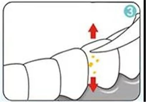 健康吃饭的正确方法,怎么样避免吃饭时塞牙