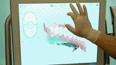 昆明龅牙矫正要多少钱,长沙轻微龅牙矫正要多少钱