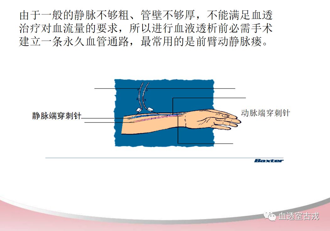 血透相关宣教视频,血透患者健康宣教题目