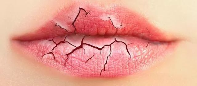 嘴唇干裂起皮怎么撕掉,嘴唇干裂脱皮润唇膏做法