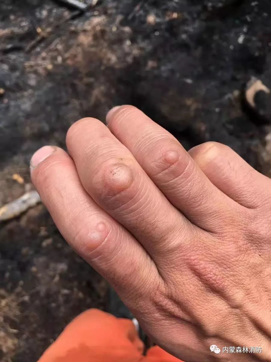 森林防火员主题教育学习心得体会,森林防火队伍如何强化使命责任感