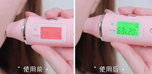 鼻头痘痘挤出来的白色物质是什么,团状红痘痘