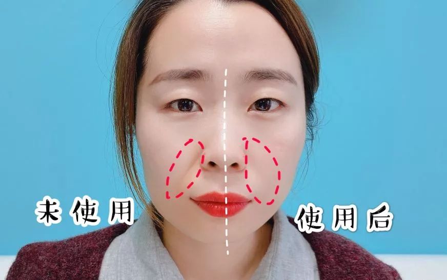 法令纹和眼纹怎么才能有效改善,法令纹贴眼贴有用吗