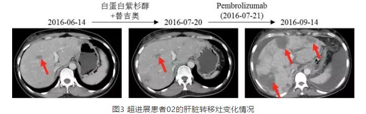 消化系统肿瘤免疫治疗方案,消化系统肿瘤预防措施