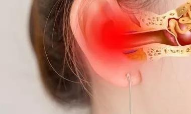 为什么有糠耳,糠耳与油耳的区别