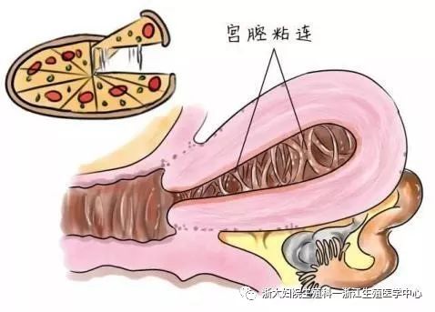 人流危害讲解视频3分钟,人流危害科普短片