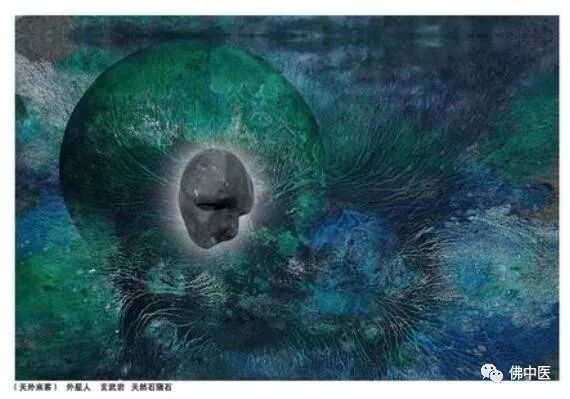 【贴心】旅居海外80载，传奇艺术家脑梗收治佛中医，大赞祖国医疗服务