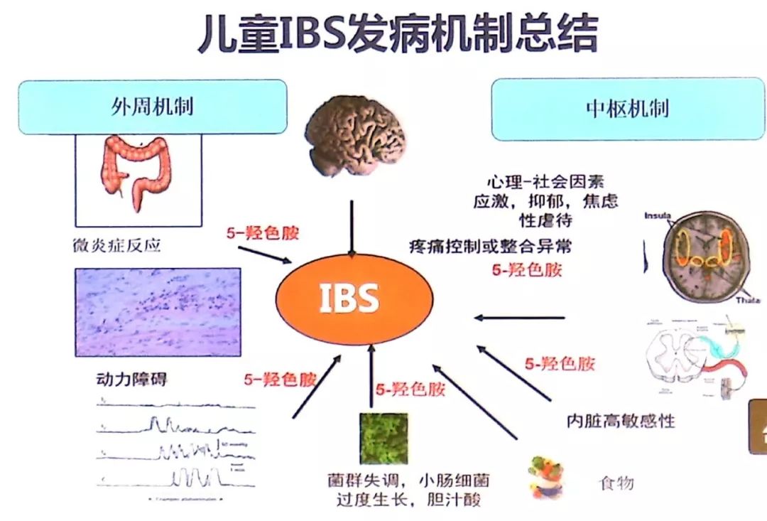 小孩反复腹痛又查不出原因,孩子反复肚子疼应该查什么