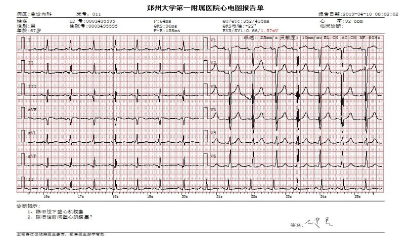 这种新药，院内就应启动治疗了