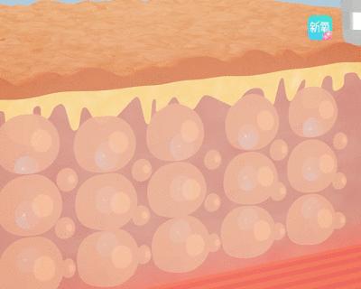 11块钱淡斑体验,1元享受美容养生护理无隐形消费