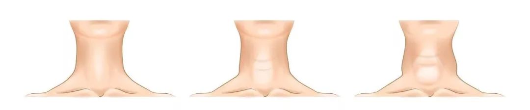 为什么有的人怎么吃都不胖反而瘦,为什么有人怎么吃都不瘦