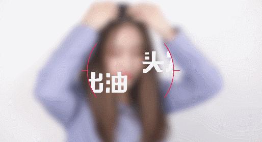 头发爱出油怎么办用什么药,头发爱出油怎么办
