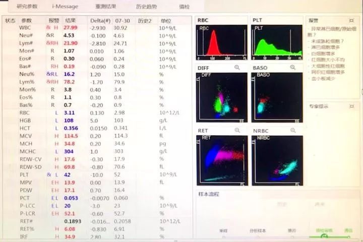 套细胞淋巴瘤胸腔侵润病例分享